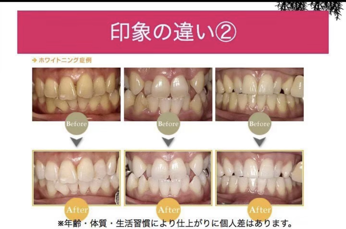 白く美しい歯で印象アップ!